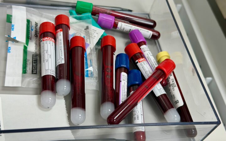 Tubos de amostras de sangue em recipiente de laboratório